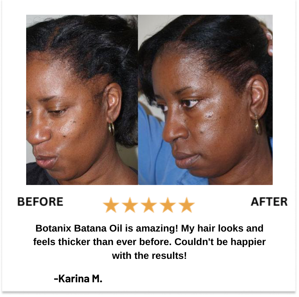 Batana Oil Travel Size