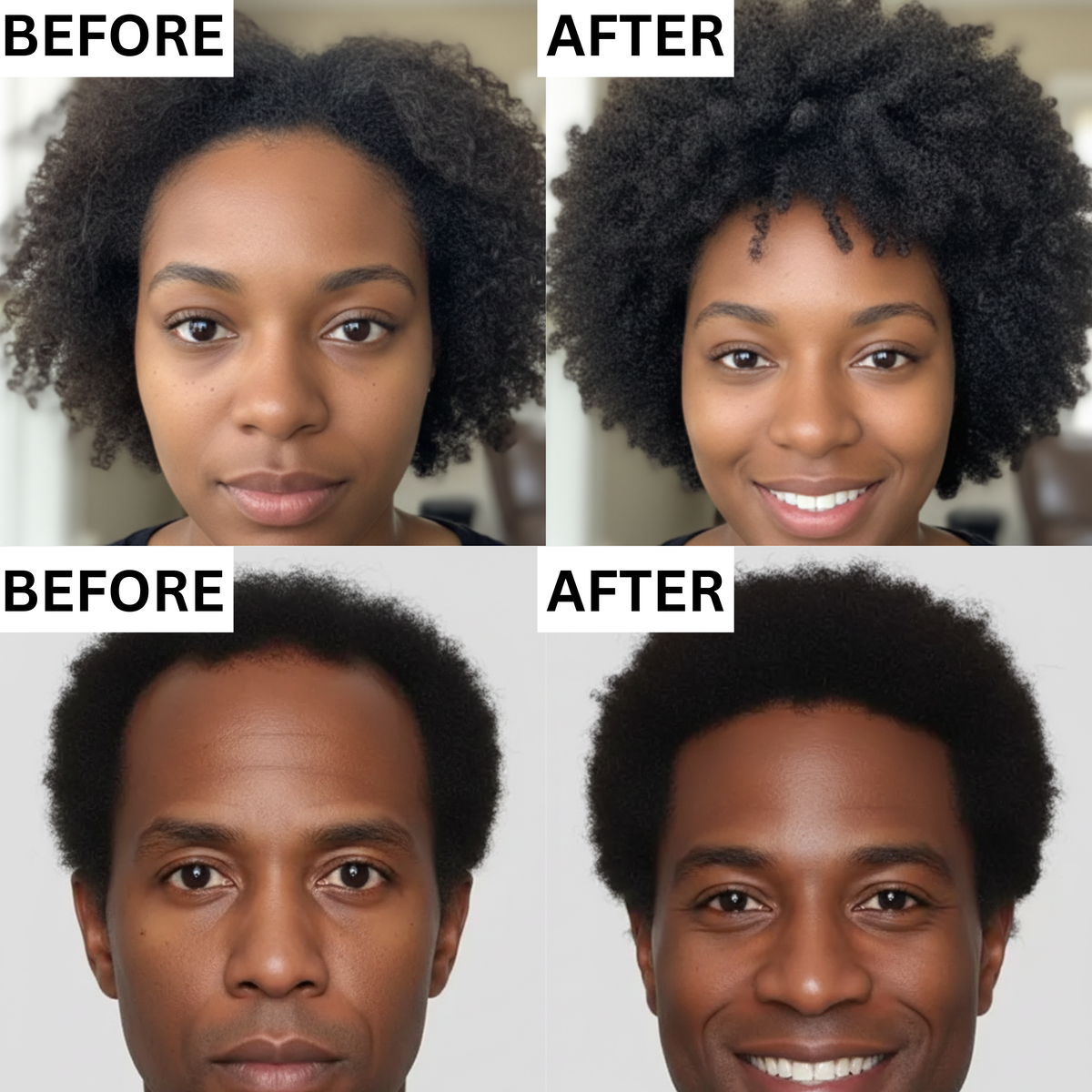 Pure Botanix Struggling with a receding hairline? – Botanix