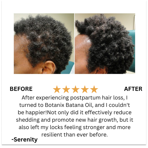 Batana Natural Hair Growth Oil – Botanix