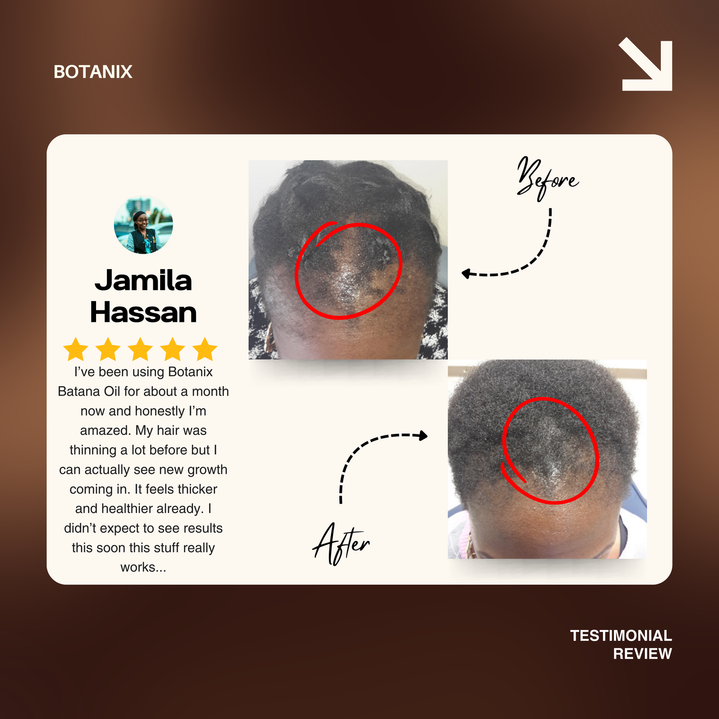 Batana Natural Hair Growth Oil