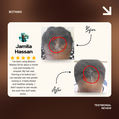 Batana Natural Hair Growth Oil