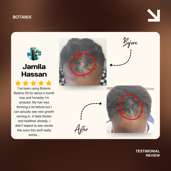 Batana Natural Hair Growth Oil