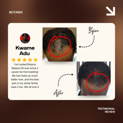 Batana Natural Hair Growth Oil