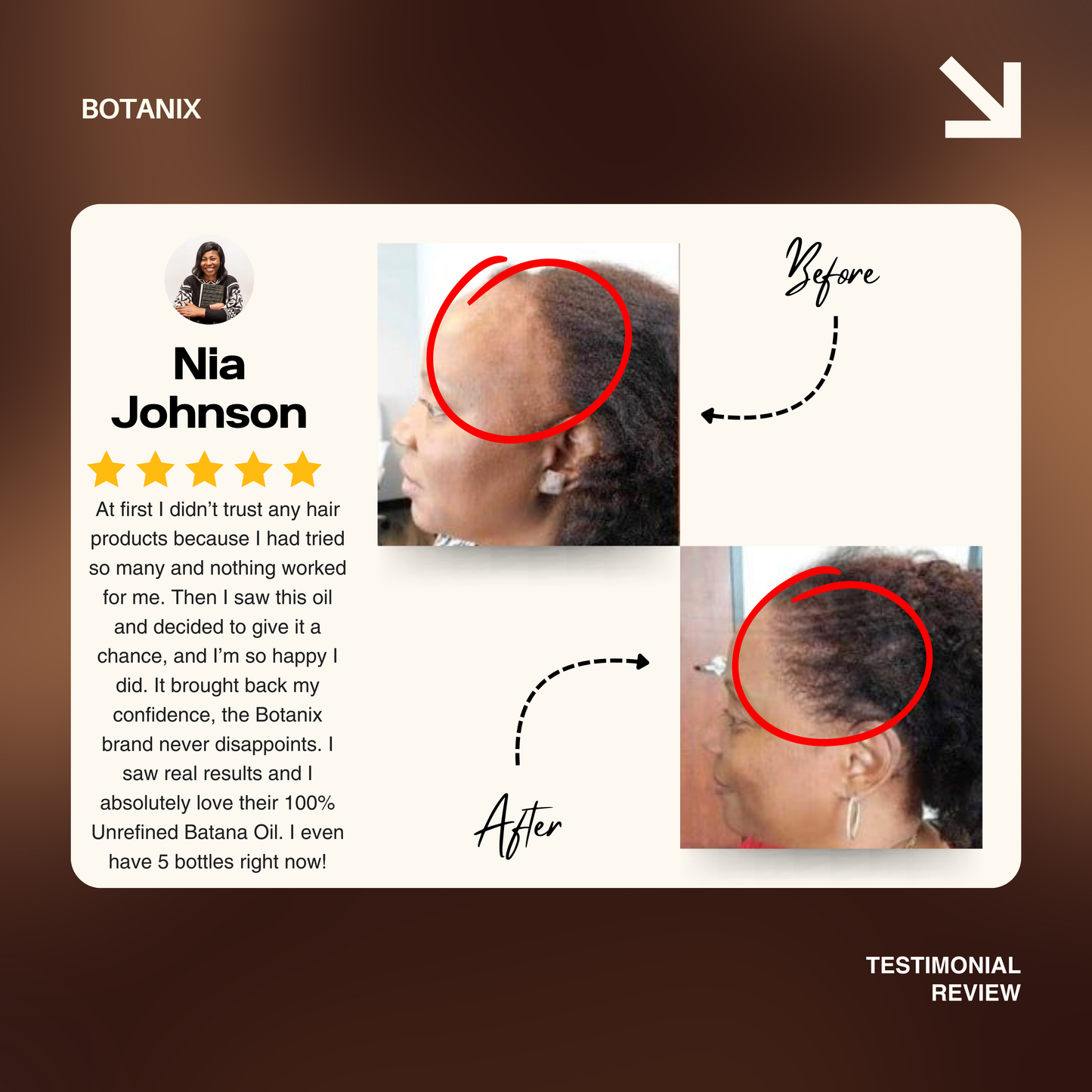 Batana Natural Hair Growth Oil